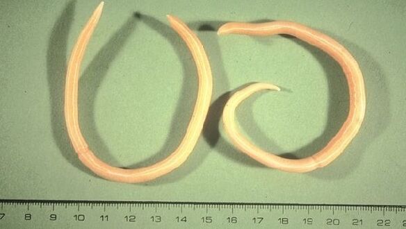Roundworms nekea eta eztul gisa agertzen diren zizareak dira.