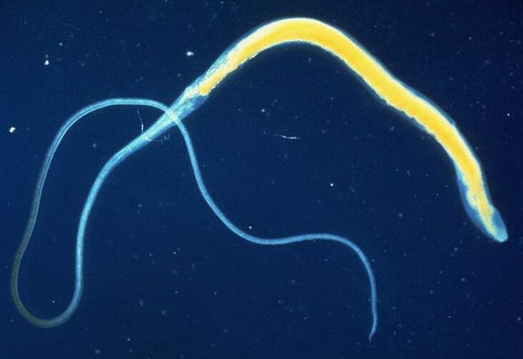 Whipworm hesteetako parasito arrunta da.